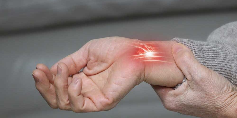 Carpal-Tunnel-Syndrome