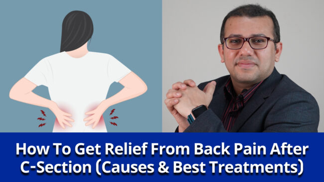 back-pain-after-c-section Back Pain After C-Section