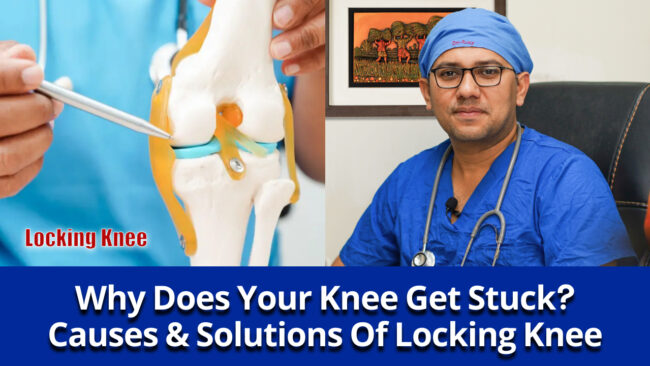 locking-knee Locking Knee