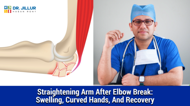 Elbow Fracture Elbow Fracture