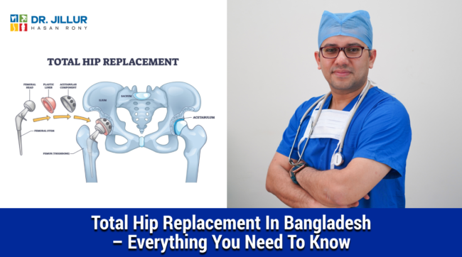 Hip Replacement Hip Replacement