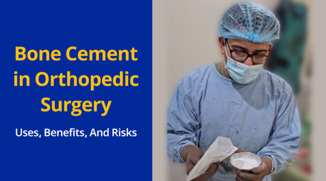 Bone Cement in Orthopedic Surgery_ Uses, Benefits, and Risks Bone Cement