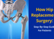 How Hip Replacement Surgery_ Step-by-Step Guide for Patients