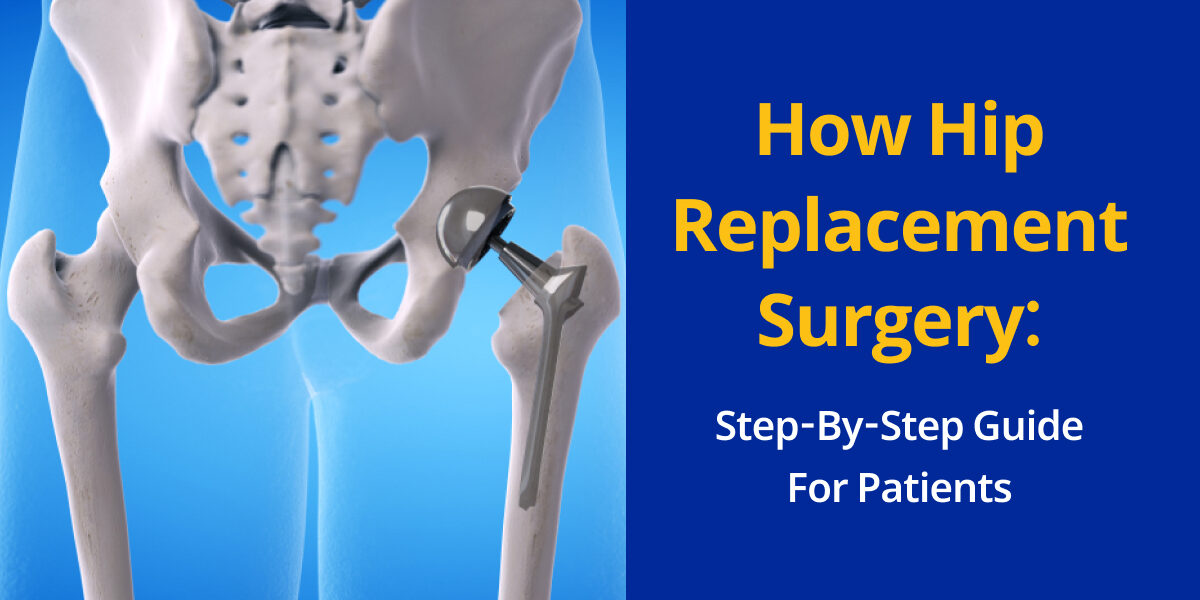 How Hip Replacement Surgery_ Step-by-Step Guide for Patients