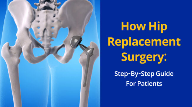 How Hip Replacement Surgery_ Step-by-Step Guide for Patients