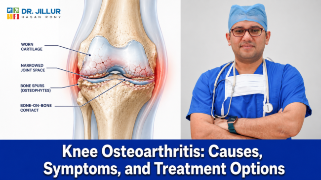 Knee Osteoarthritis: Causes, Symptoms, and Treatment Options