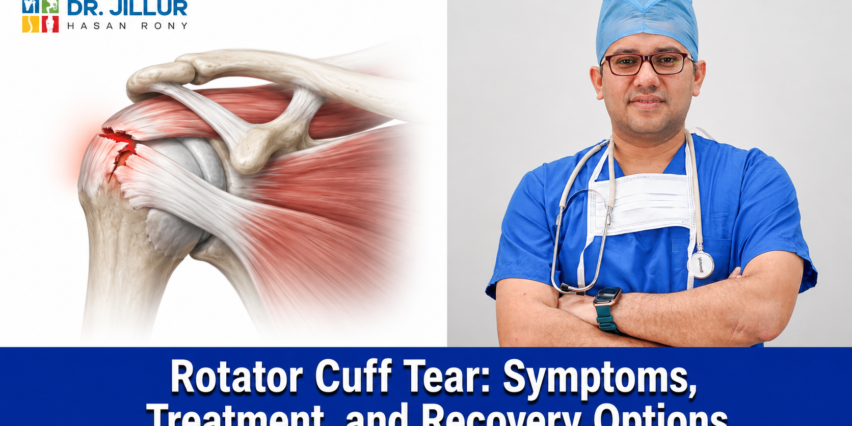 Rotator Cuff Tear Symptoms, Treatment, and Recovery Options Rotator Cuff Tear: Symptoms, Treatment, and Recovery Options