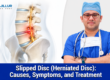 Slipped Disc (Herniated Disc): Causes, Symptoms, and Treatment