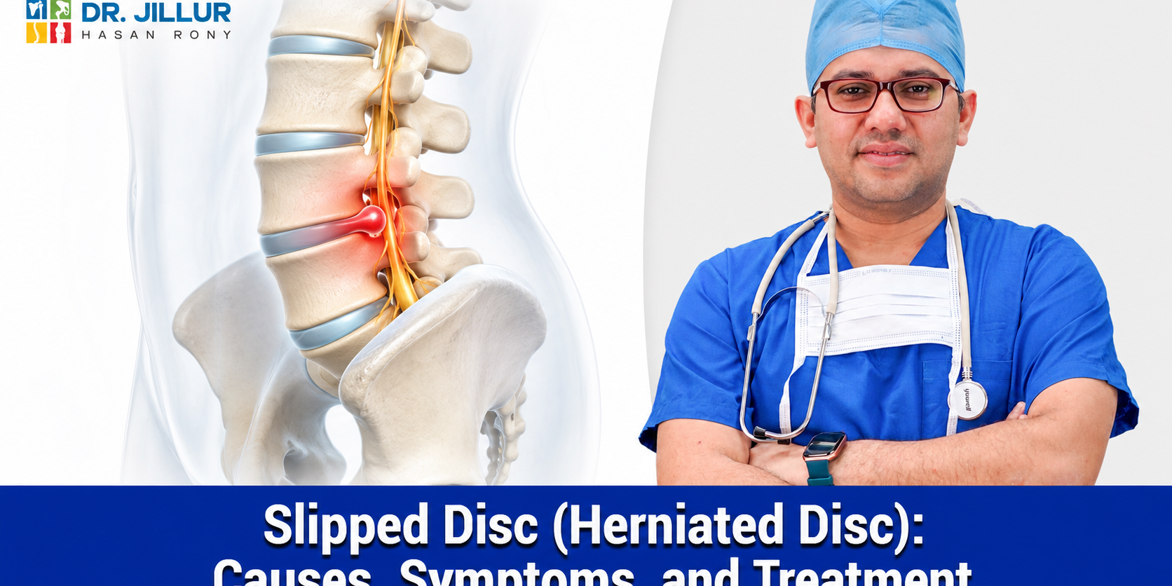 Slipped Disc (Herniated Disc) Causes, Symptoms, and Treatment Slipped Disc (Herniated Disc): Causes, Symptoms, and Treatment