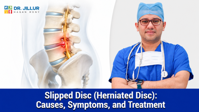 Slipped Disc (Herniated Disc): Causes, Symptoms, and Treatment